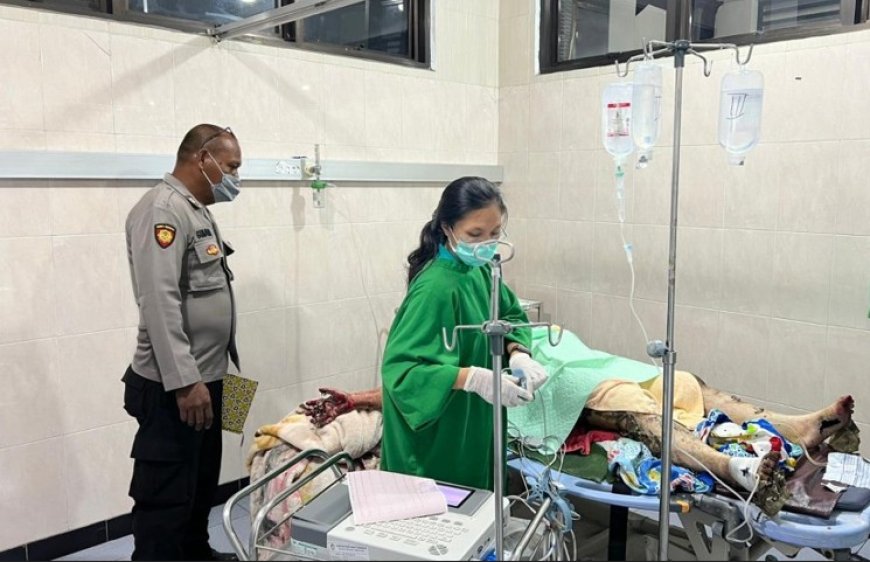 Dipicu Cekcok Soal Ekonomi, Suami Diduga Bakar Istri di Banyuwangi